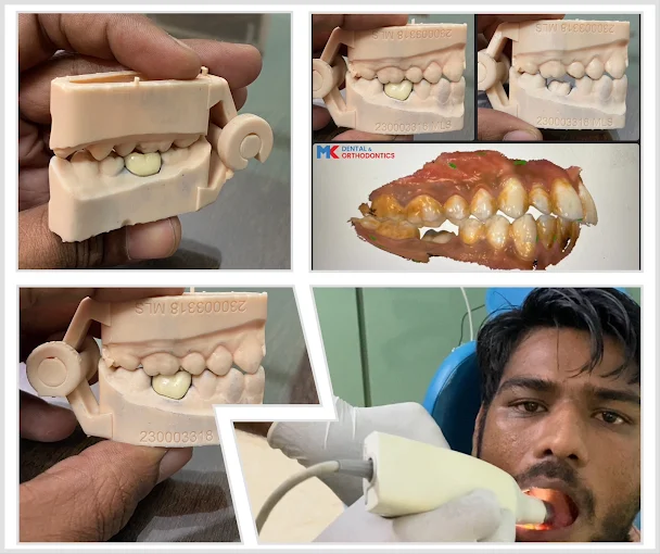 Dental treatment in progress